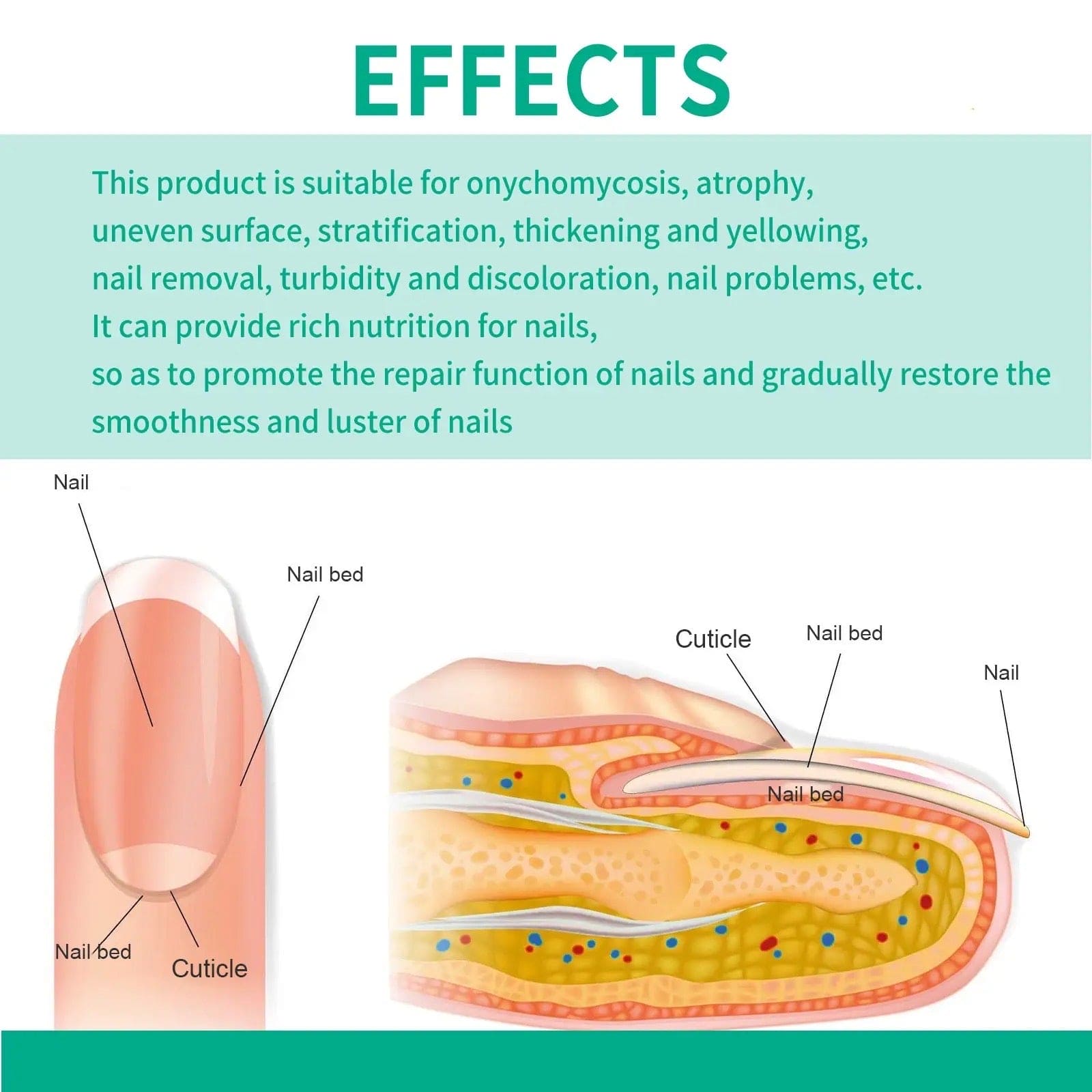 Nail Fungus Solution, Anti Infection Nail Fungus Removal Gel, Ingrown Toenail Treatment Nail Care Oil, Nail Fungus Treatments Serum Nail Fungus Solution, Anti Infection Nail Fungus Removal Gel, Ingrown Toenail Treatment Nail Care Oil, Nail Fungus Treatments Serum